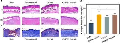 Antibacterial and antioxidant phlorizin-loaded nanofiber film effectively promotes the healing of burn wounds